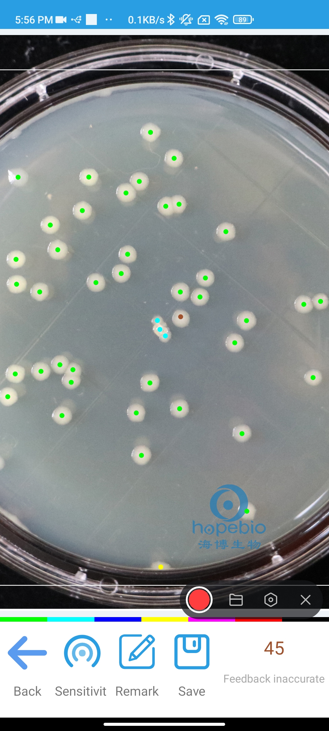 How To Automatically Count Bacterial Colonies